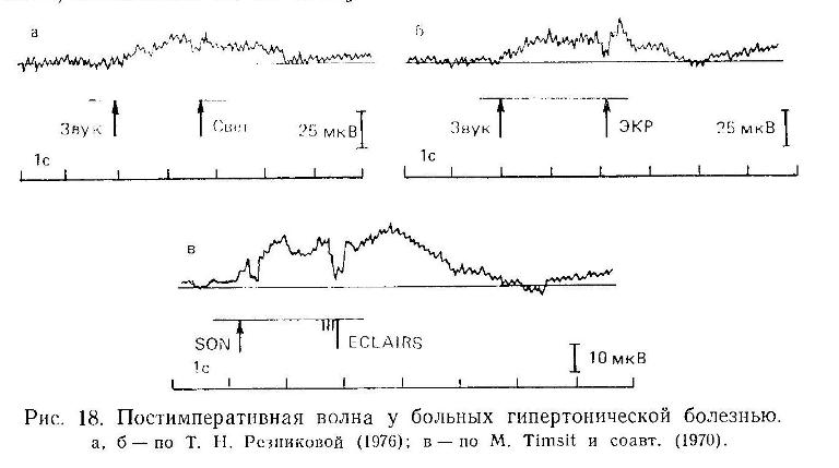 Глава 9. Некоторые психофизические методы исследования (продолжение)
